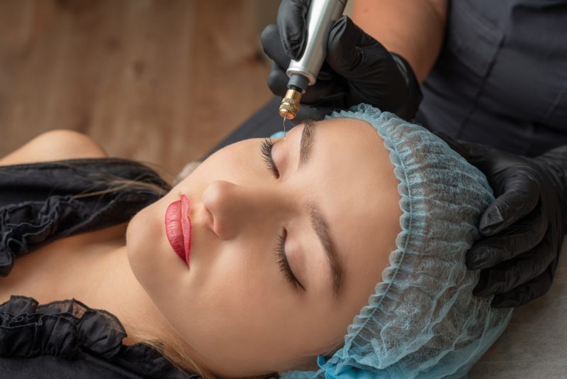 Plasma Fibroblast Therapy