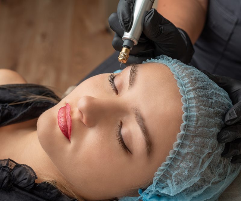 Plasma Fibroblast Therapy